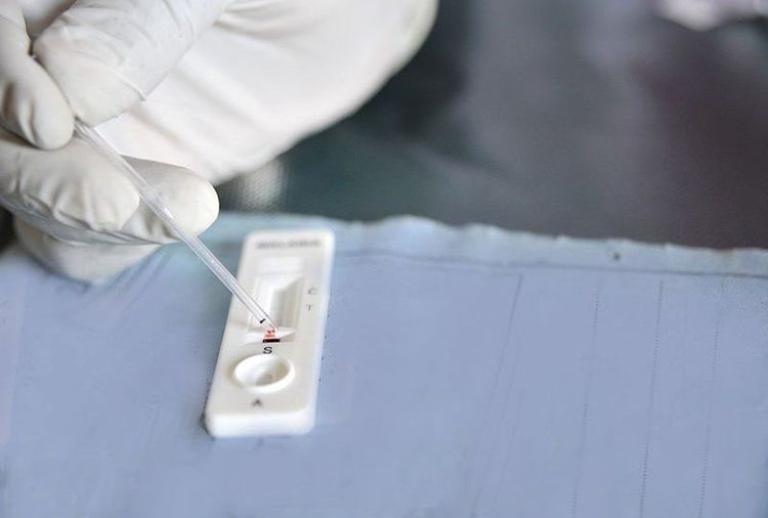 Quy Trình Thực Hiện Test Nhanh Chẩn Đoán Sốt Rét Tại Cơ Sở Y Tế